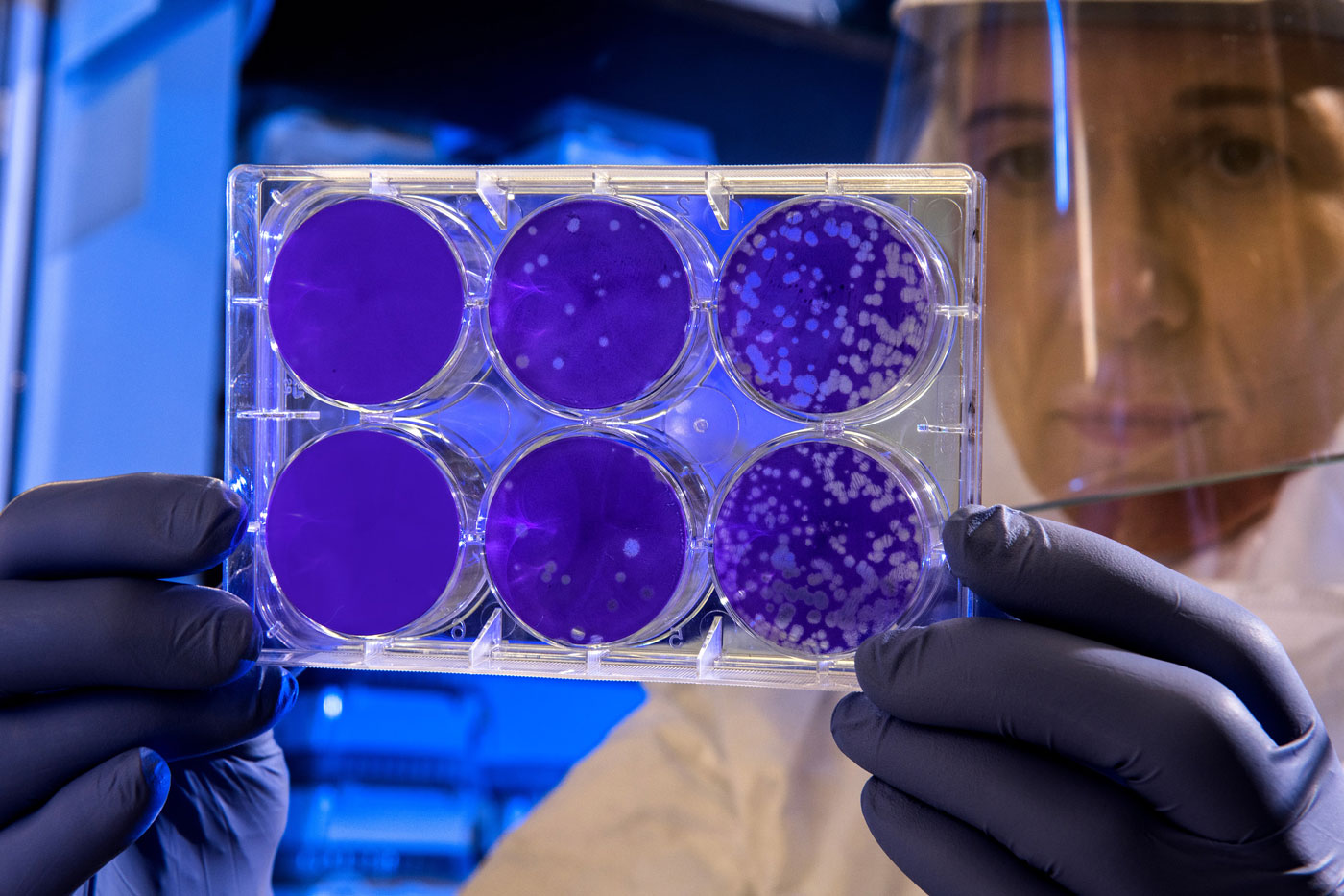 💊 Нідерландські вчені, можливо, знайшли антитіла проти коронавірусу (але це не точно)
