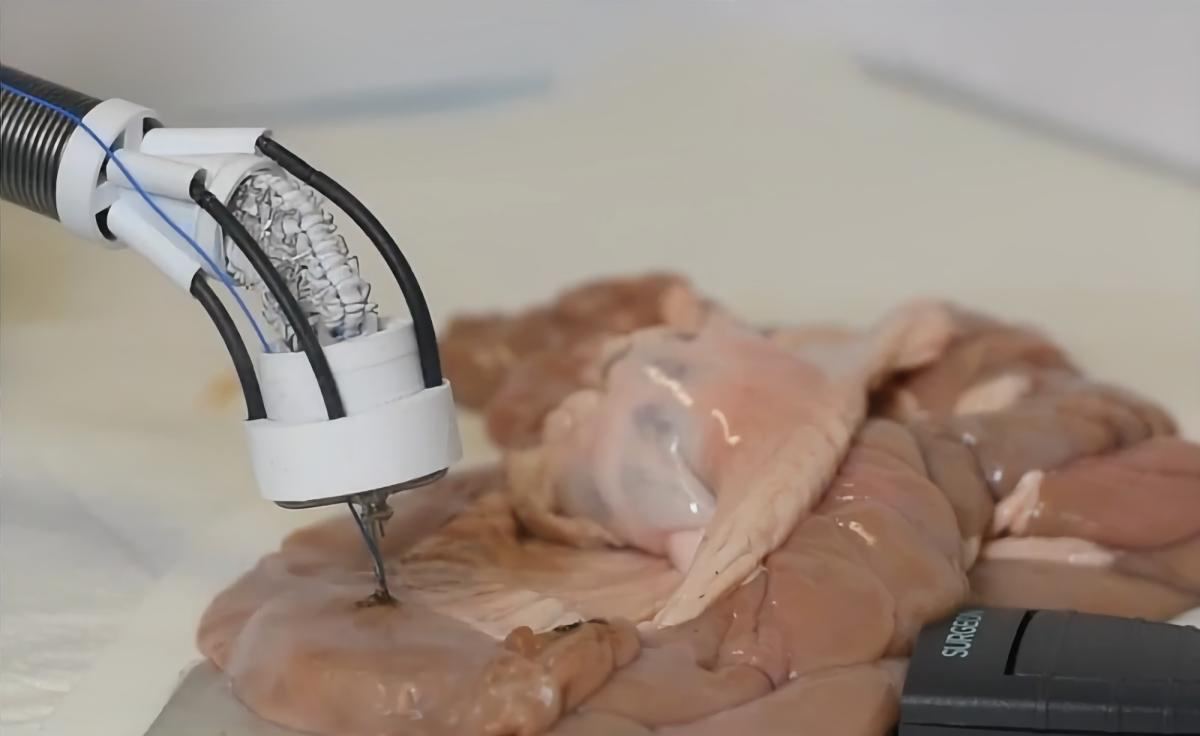 🧠 Австралійські науковці винайшли 3D-принтер, який може друкувати біоматеріал для пошкоджених органів